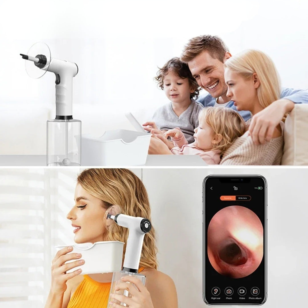 WhispEar™ - Ear Wax Remover
